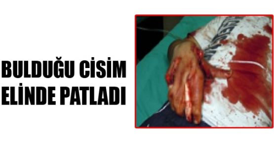 Bulduğu cisim elinde patladı: 1 yaralı